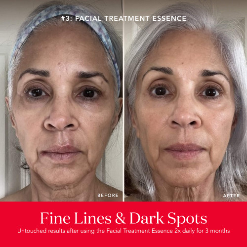 PITERA™ Anti-Aging Set slide2