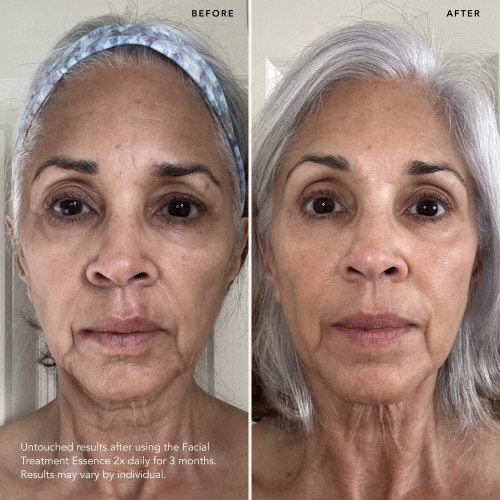 SK-II First Experience Kit with facial treatment essence, facial treatment clear lotion, and a facial treatment mask slider4 