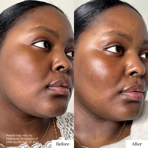 SKINPOWER Advanced Cream: Day and night face cream & skin moisturizer for dry skin, wrinkles and fine lines slider2