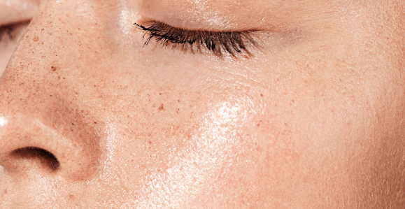 Types of Skin Suitable for Vitamin C Application